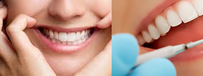 Cosmetic Dentistry In Sushant Lok