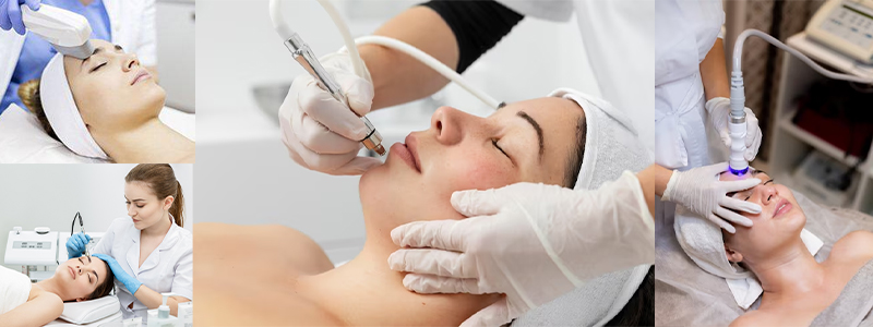 Laser Acne Scar Removal In South City 1