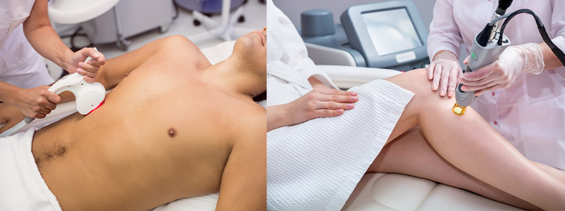 Permanent Laser Hair Removal In Ardee City